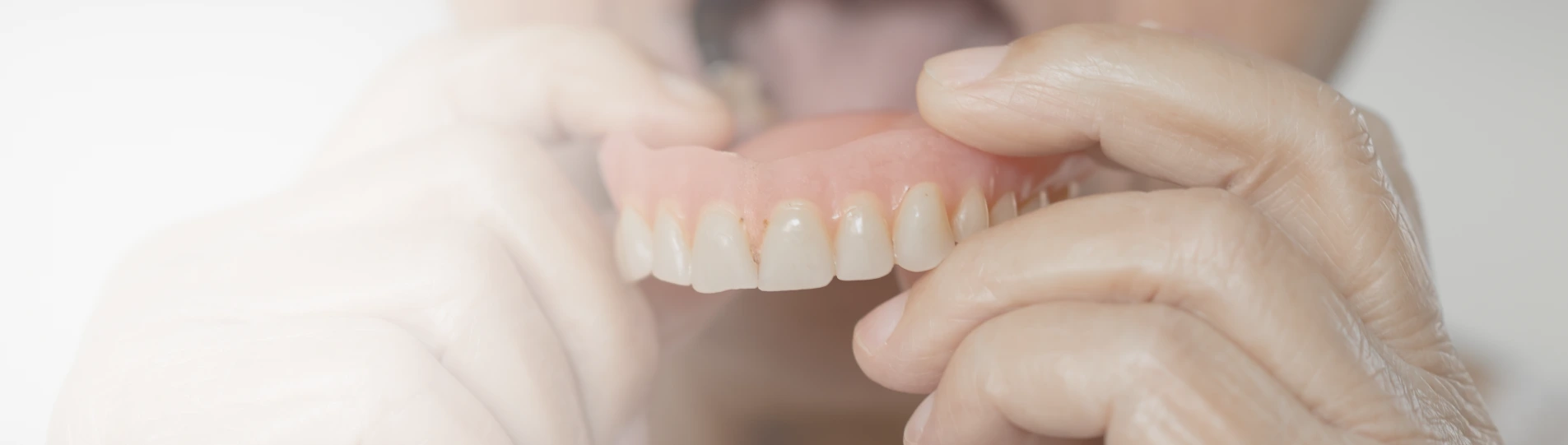 Woman smiling with healthy, natural-looking teeth – representing modern prosthetic restoration results.