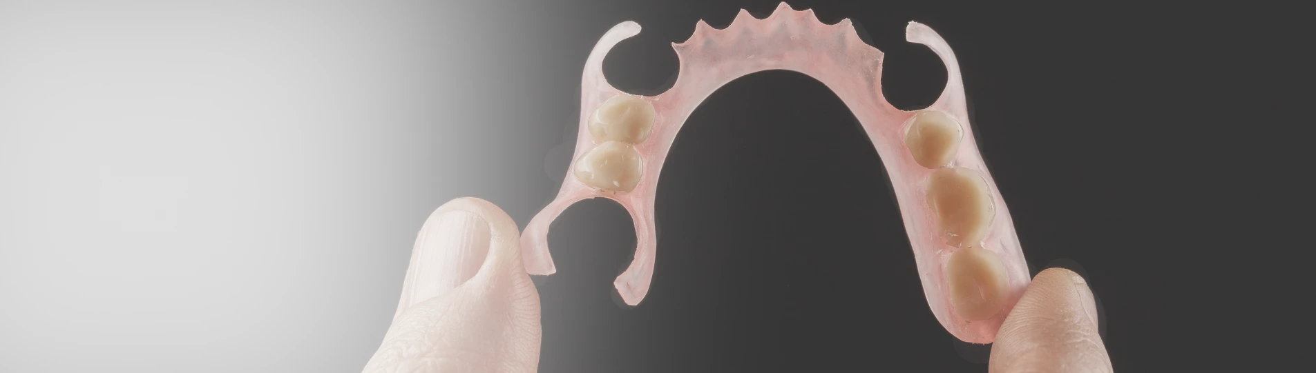 Partial acrylic denture held in hands, removable denture with artificial teeth