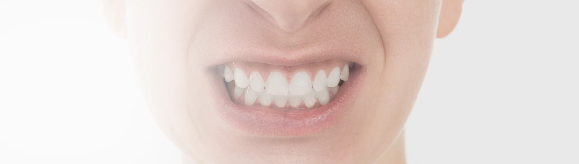 Person clenching their teeth – illustration of teeth grinding (bruxism).