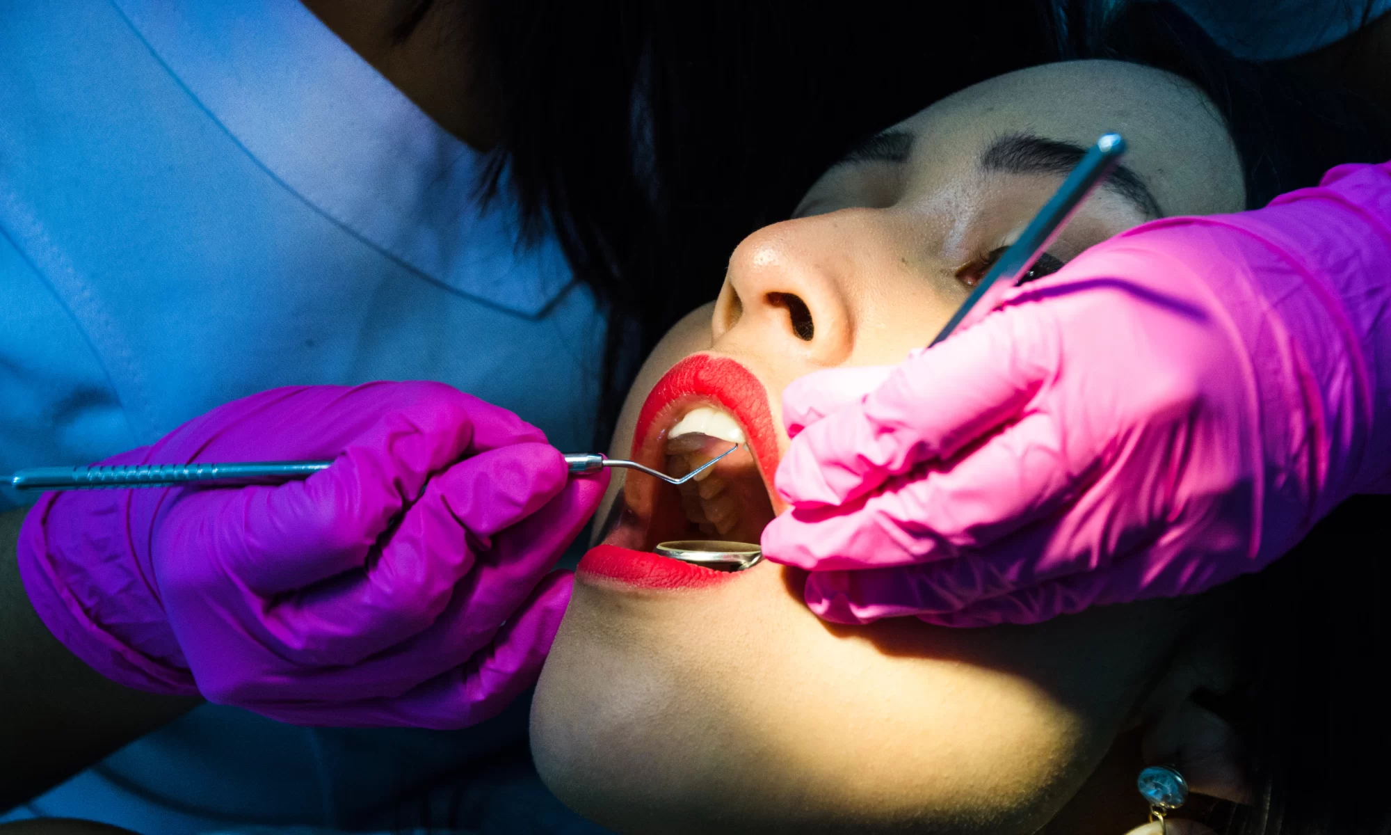 Stomatolog u ružičastim rukavicama obavlja pregled zuba pacijentkinje koristeći dentalno ogledalo i sondu