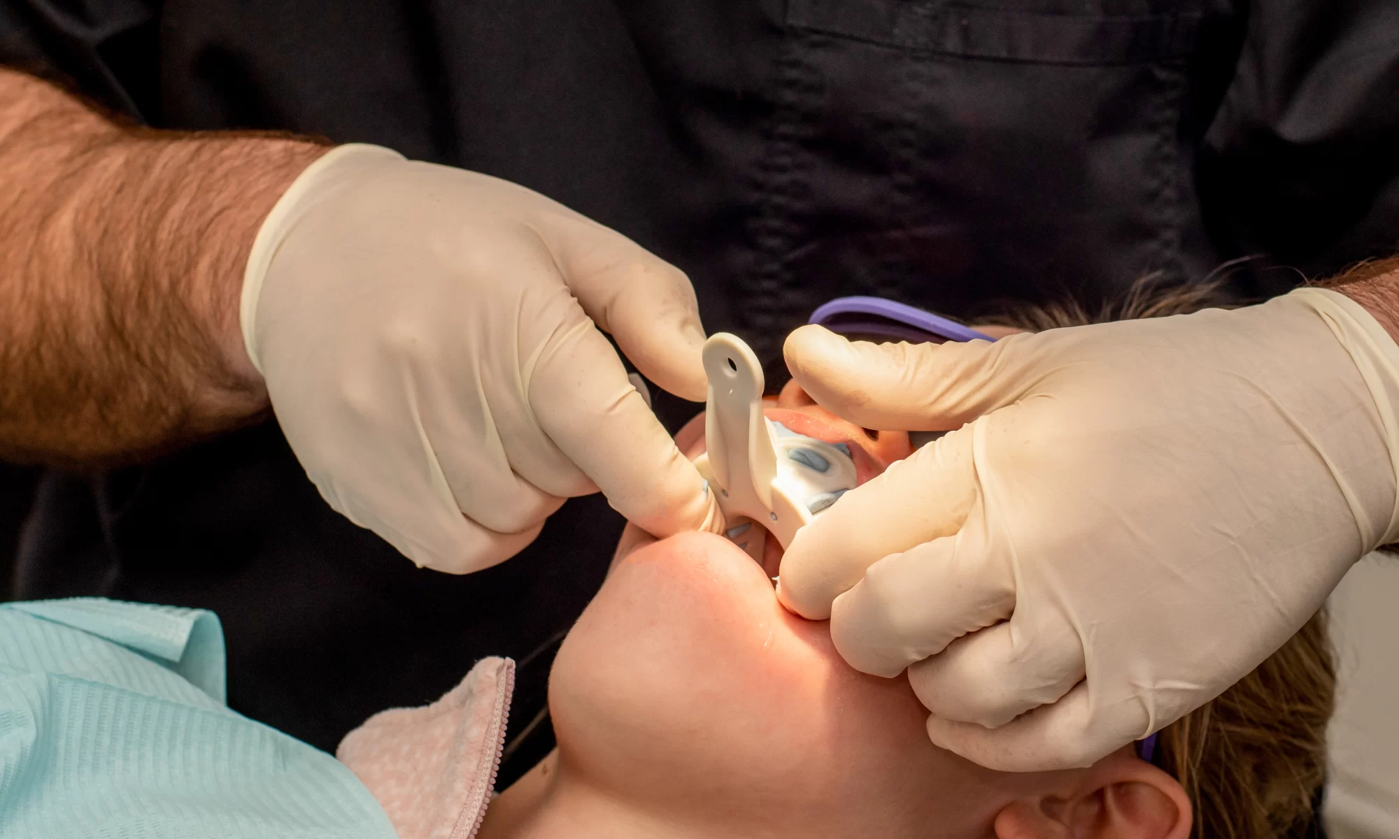 Stomatolog u zaštitnim rukavicama izvodi terapijski tretman u ustima pacijenta koristeći specijalizirani instrument